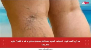 دوالي الساقين: أسباب خفية ومخاطر صحية خطيرة قد لا تكون على علم بها